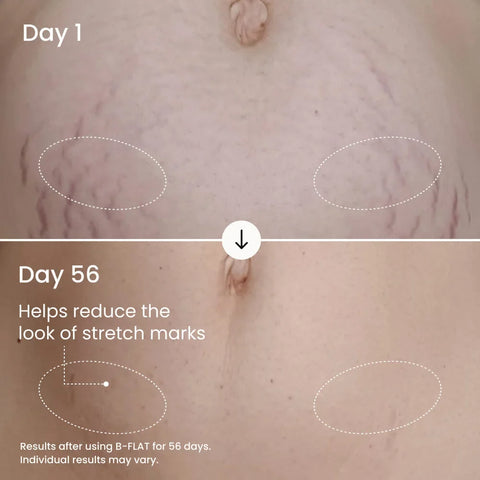 B-FLAT Belly Firming Cream