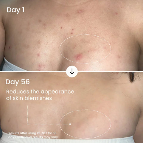 RE-SET Balancing Body Serum