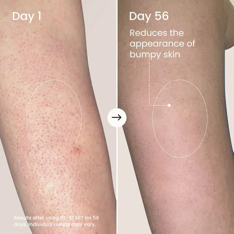 RE-START Resurfacing Body Serum