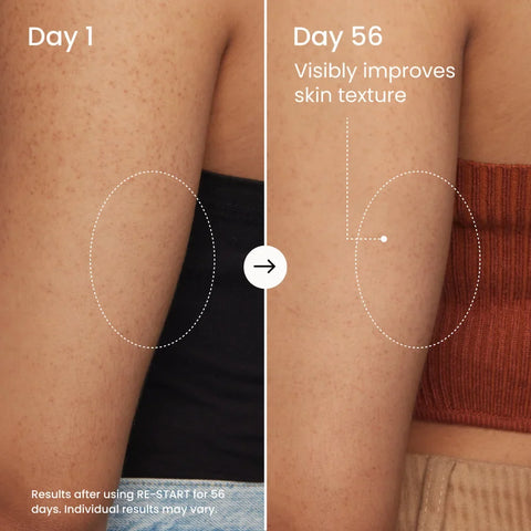 RE-START Resurfacing Body Serum